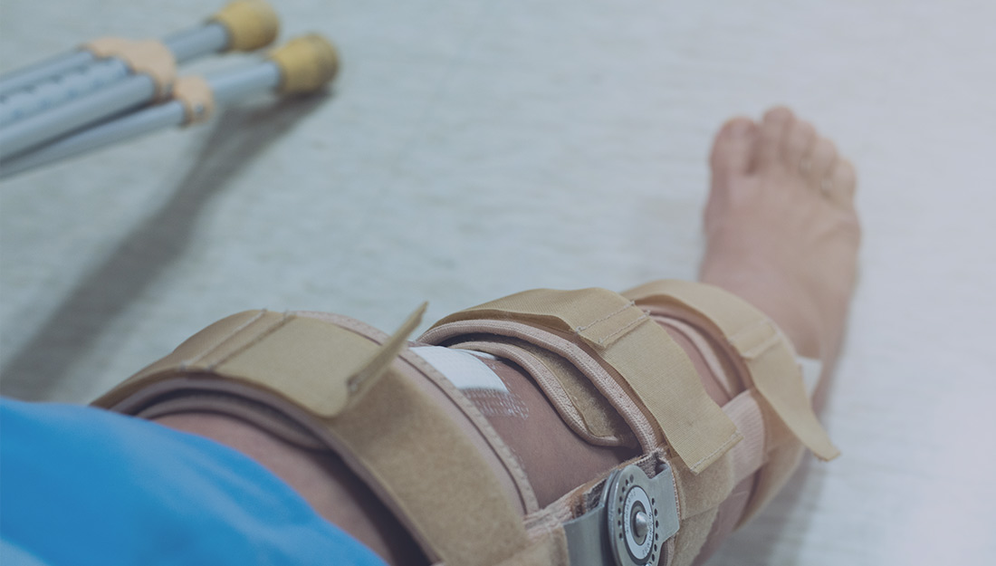 Prehab 7 Ways Preoperative Physical Therapy Intervention Can help