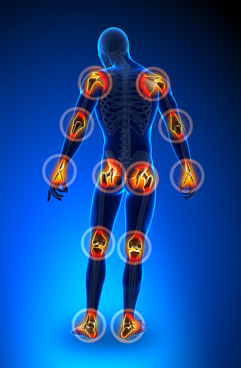 Physical therapy for muscle and joint pain at Optimum Wellness Centers - graphic image