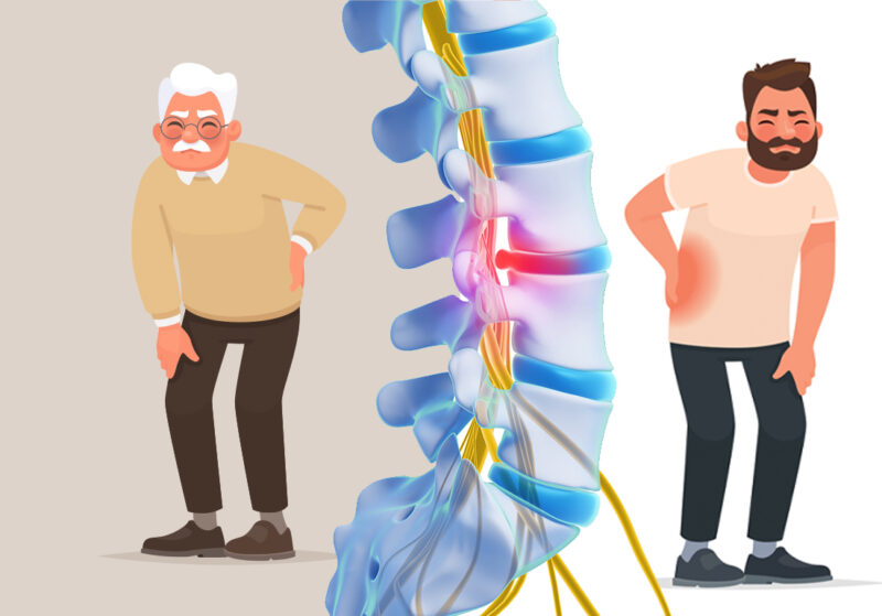 Herniated Disc Young Age at Joseph French blog