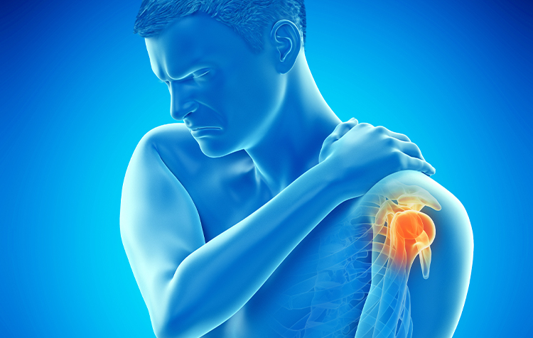 Shoulder Pain Image