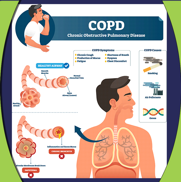 COPD and physical therapy techniques - cover image